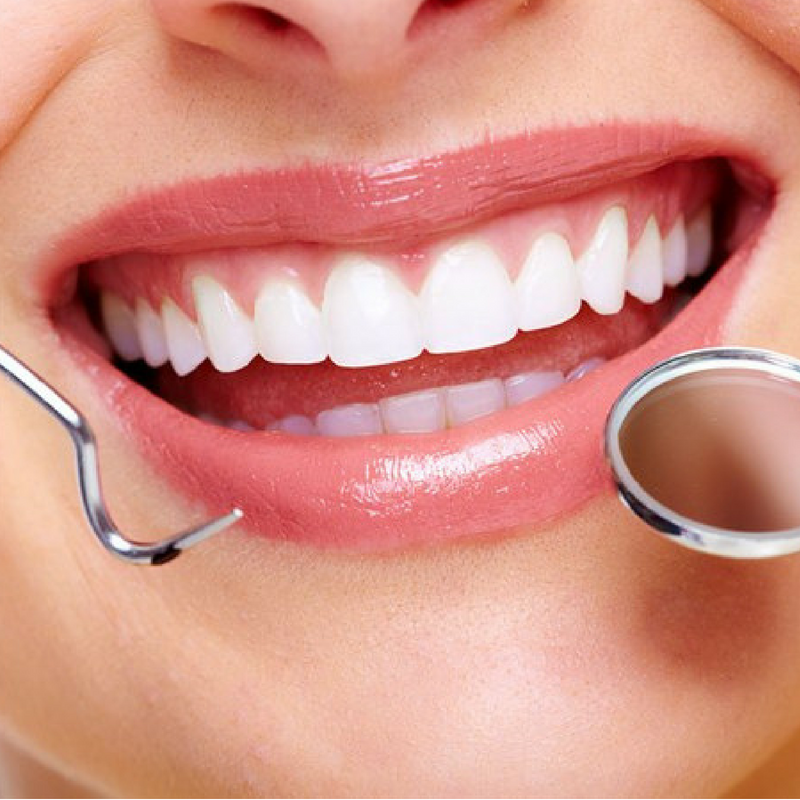 Thiết kế không tên