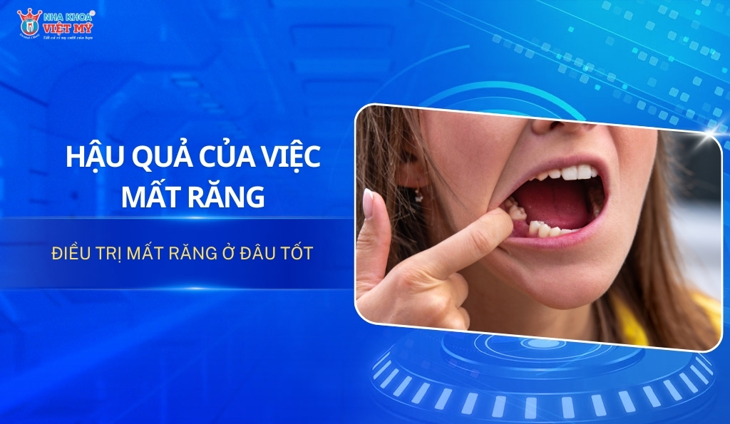 thumbnail hậu quả của việc mất răng