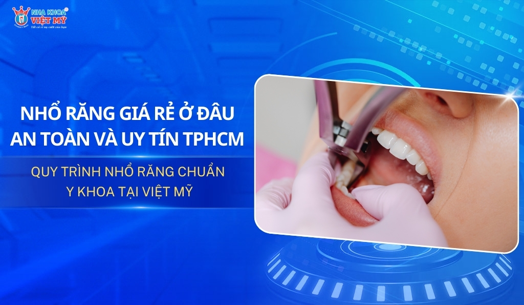 Nhổ răng giá rẻ ở đâu tại TPHCM uy tín và an toàn?