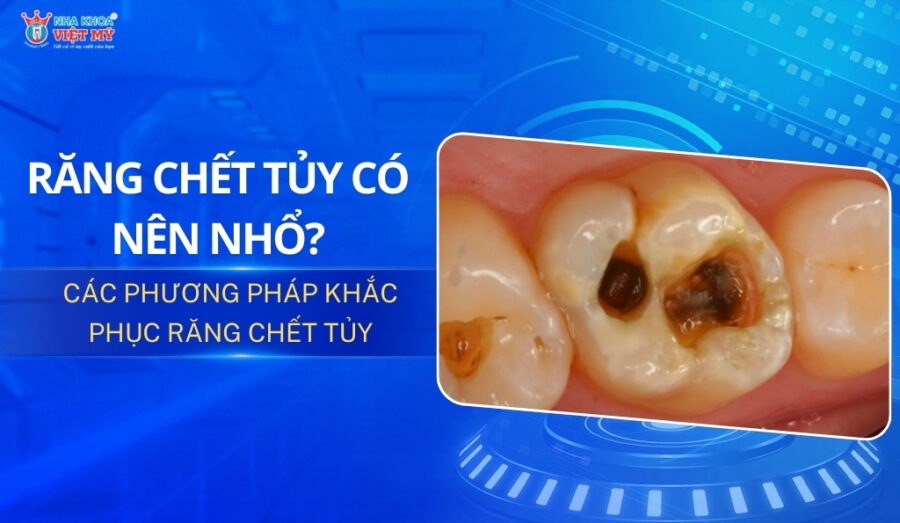 thumbnail răng chết tủy có nên nhổ