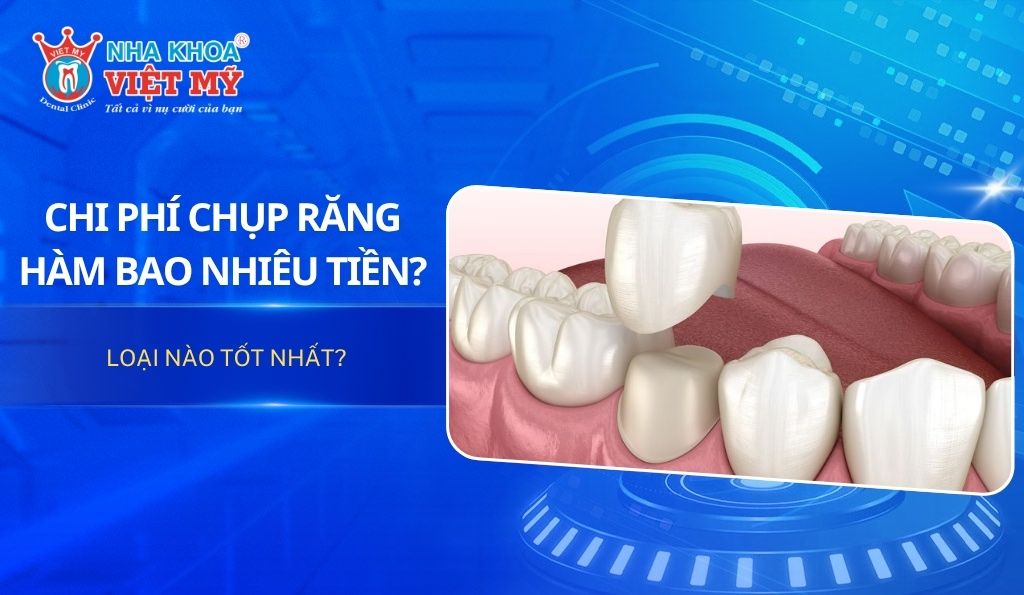 Chi phí chụp răng hàm bao nhiêu tiền? Loại nào tốt nhất?