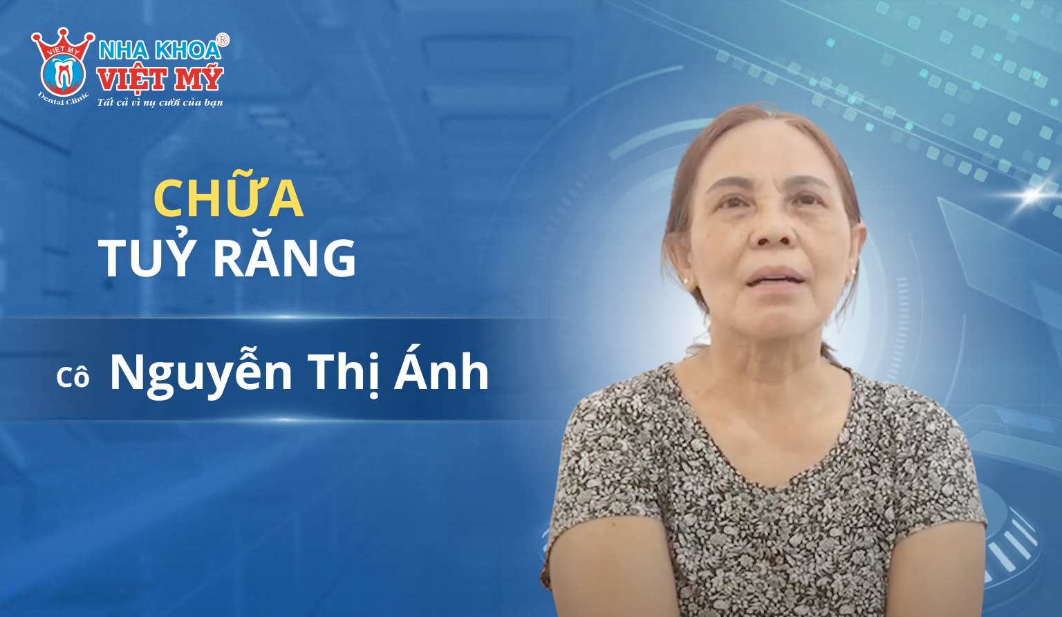 Trải Nghiệm Chữa Tủy Răng Tại Nha Khoa Việt Mỹ - Cô Nguyễn Thị Ánh
