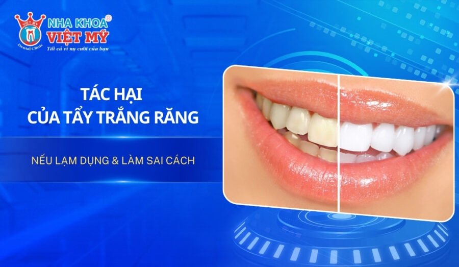Tác hại của tẩy trắng răng nếu lạm dụng & làm sai cách